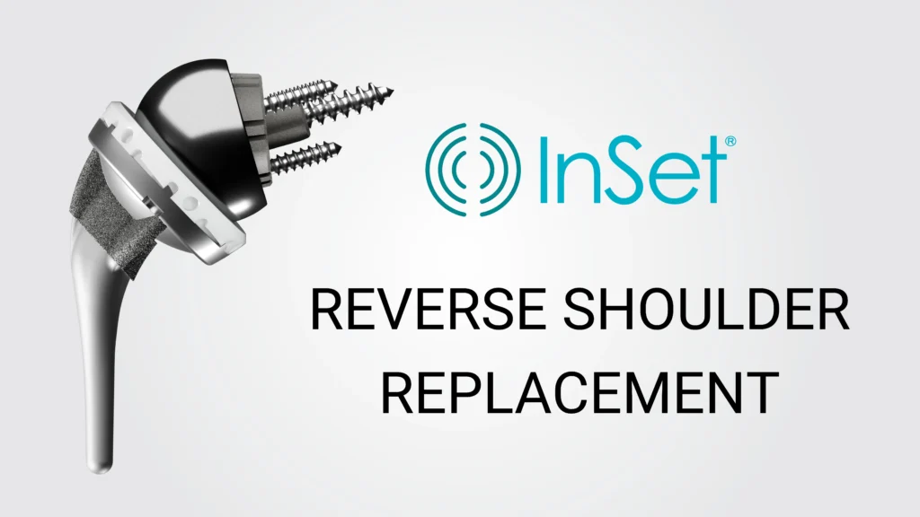 The InSet®️ Reverse Shoulder implant from Shoulder Innovations